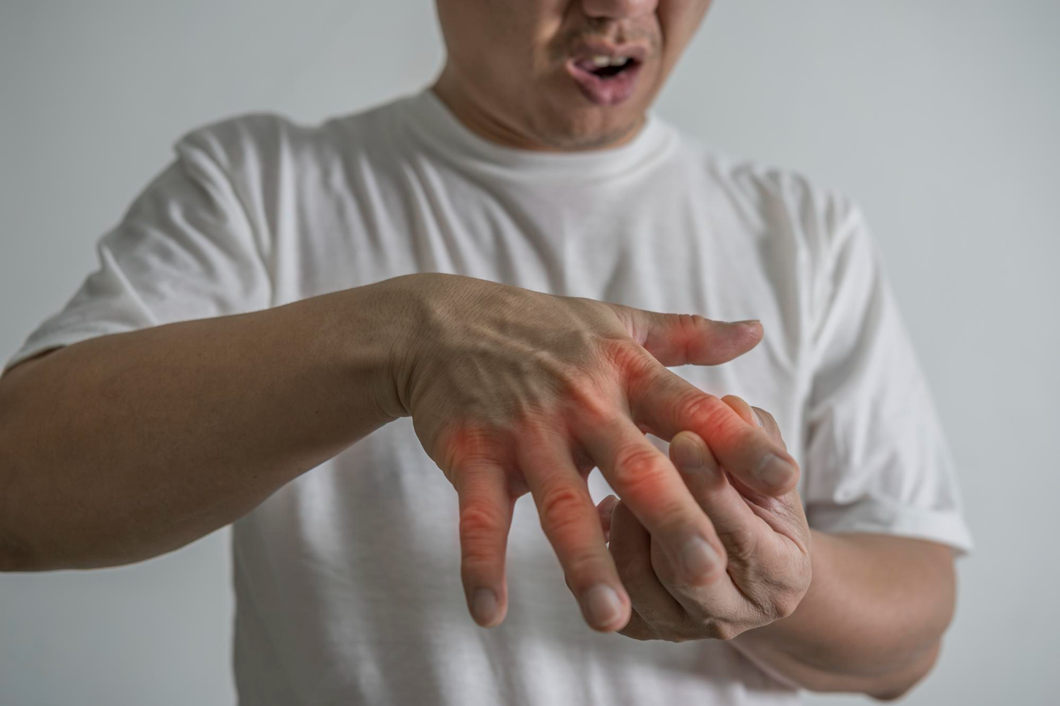 Rheumatoid Arthritis​